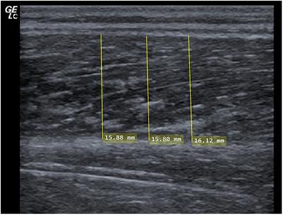 Critical evaluation of commonly used methods to determine the concordance between sonography and magnetic resonance imaging: A comparative study